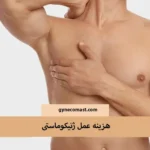 هزینه عمل ژنیکوماستی در مشهد