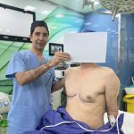 Gynecomastia in the elderly