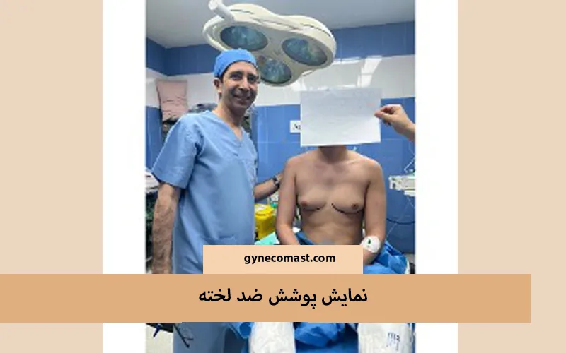 آمادگی عمل ژنیکوماستی